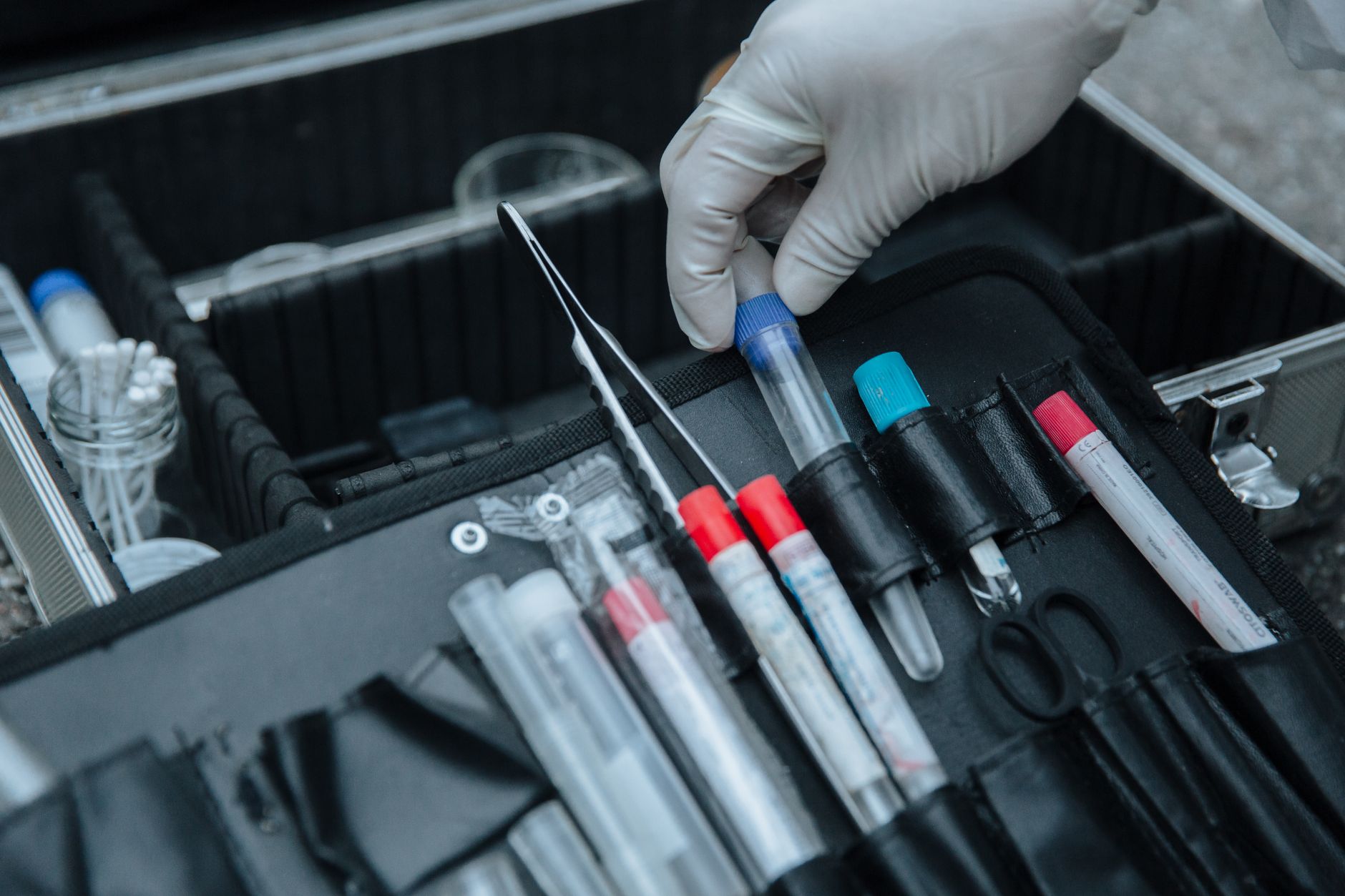 Legionella Encephalopathy Cases